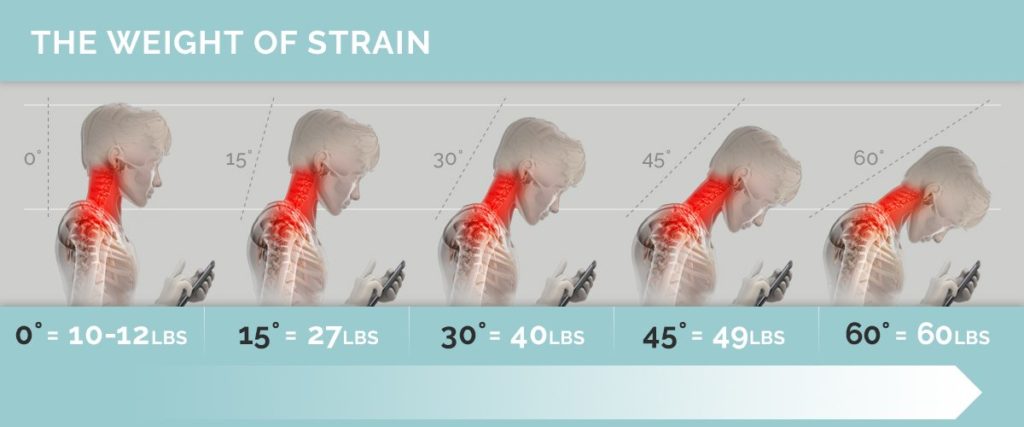 skeletal images strain angles neck